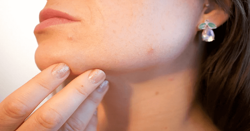 Micro Dart Patch: Reasons for Avoiding Non-Dermatologist Product
