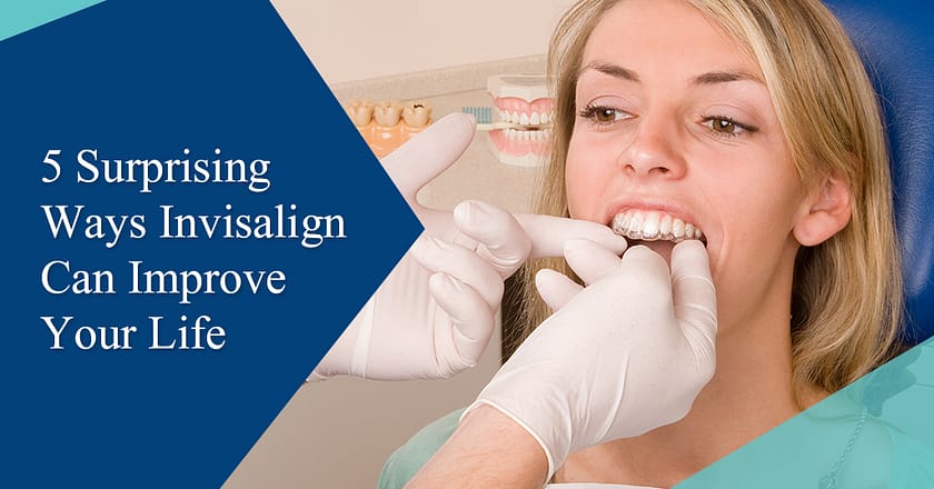 5 Surprising Ways Invisalign Can Improve Your Life