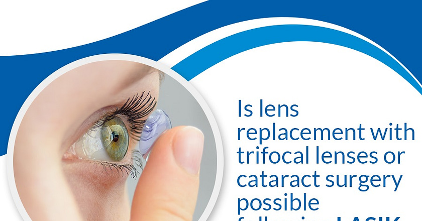Is Lens Replacement With Trifocal Lenses Or Cataract Surgery Possible Following LASIK?