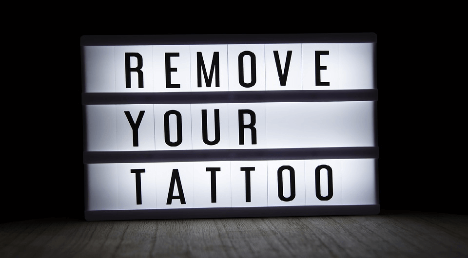 remove tattoo